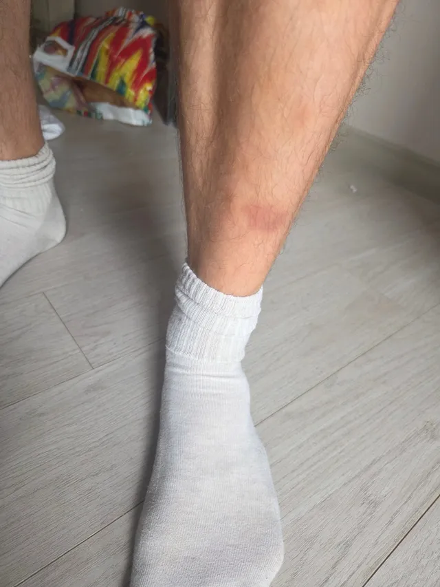 Leg after Muay Thai, I promise it looks worse in person